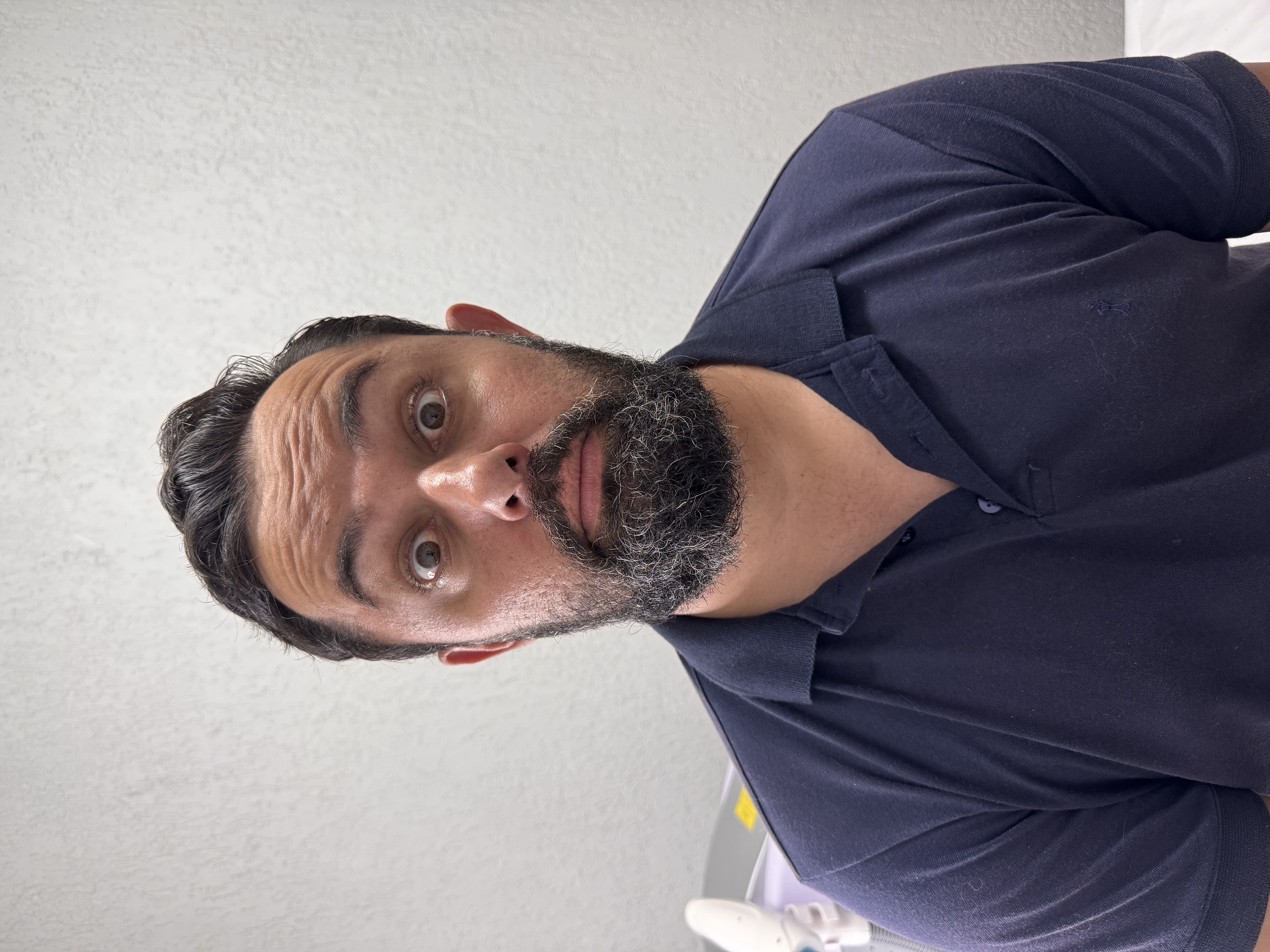 Antes - Toxina Botulínica